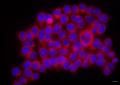 Intestinal cells incubated with probiotic yeast vesicles.