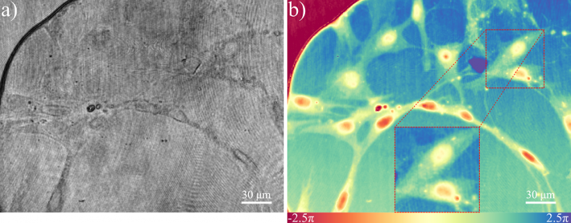 Left: a cell visible under a microscope based on light absorption. Right: a cell visible under a phase microscope.