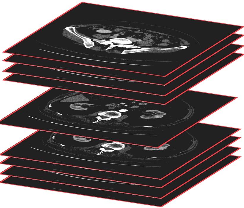 A set of CT scans analyzed automatically by computer systems